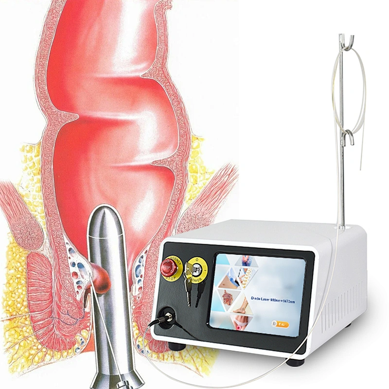 Hot Selling 980nm 1470nm Hemorrhoids Treatment Laser Diode Machine