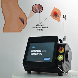 980nm1470nm Proctology Surgical Treatment Machine High Power Removal Fistula Hemorrhoids Pilonidal Sinus