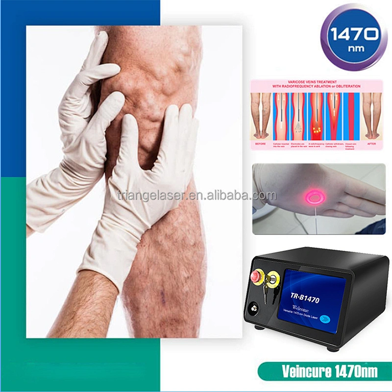 Surgery Minimally-invasive 1470nm EVLT EVLA Laser Machine Varicose Veins Ablation Treatment