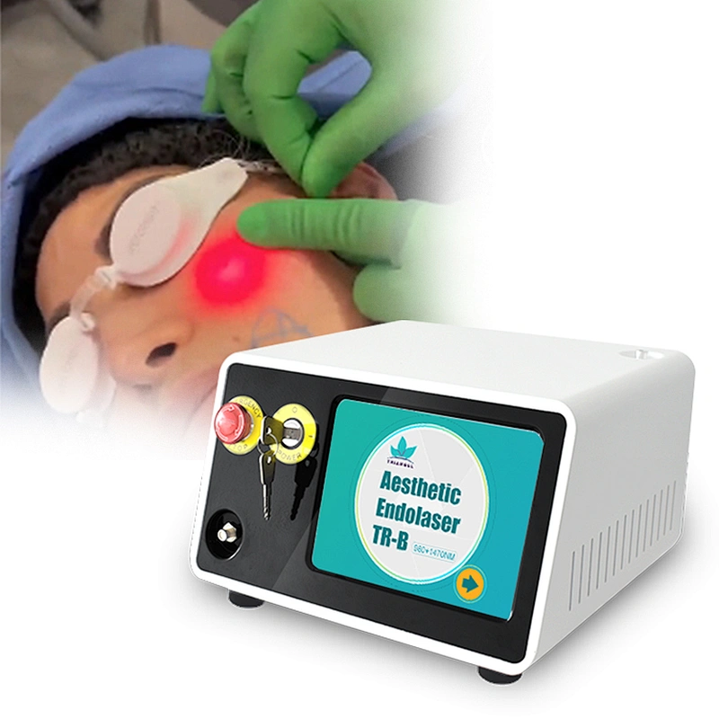 Newest Endolaser 1470nm 980nm Diode Laser Face Lifting Liposuction Machine Liposuct Endo Laser Lift