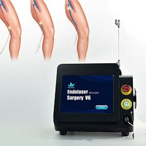 Dual Wave 980nm Class Iv Surgical Laser Equipment for Varices Des Membres Inferieurs Varicose Veins Evlt  Evla Varice