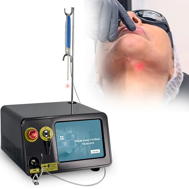 Vaser Liposuction Equipment Diode Laser 1470nm 15W Skin Tightening/Body Shaping Slimming Liposuction Laser Machine