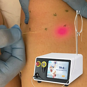 Portable Liposuction Device Portable Liposuction Endolaser Diode 980nm 1470 Machine