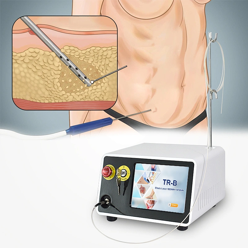 980nm 1470nm Laser Liposuction Assisted Diode Laser Slimming Machine Lipolysis Lipo Vaser Endolaser Machine