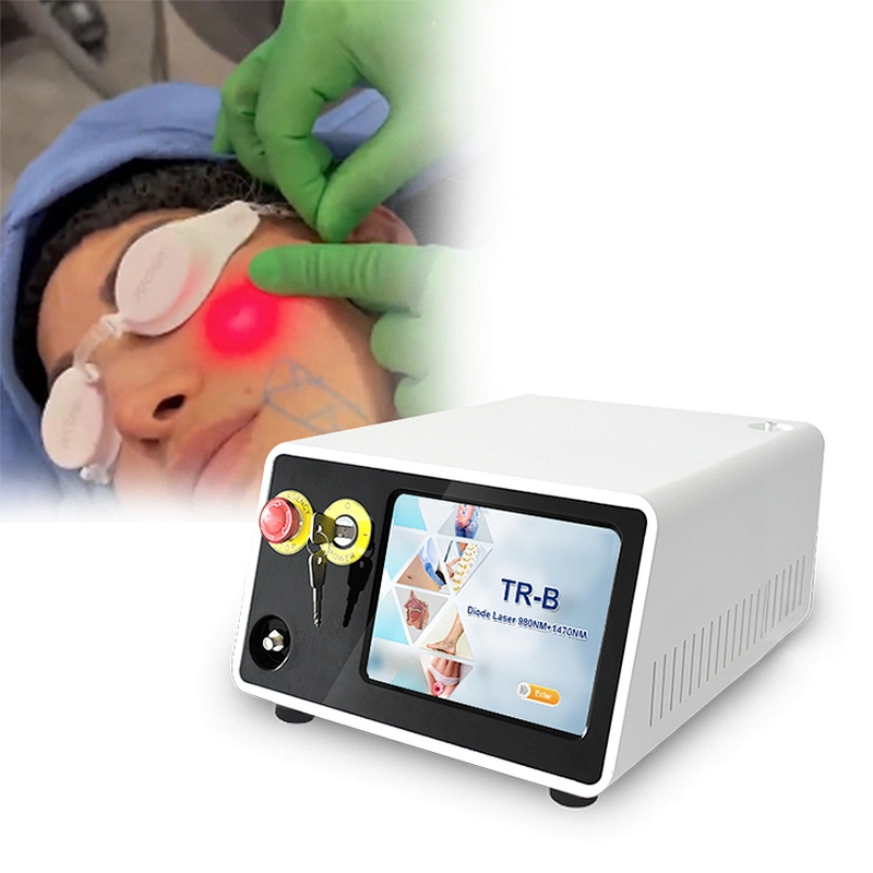Laser Liposuction Machine 980nm 1470nm Fat Removal Lipomas  Laser Beauty Machine Face Lifting Liposuction Surgery Endolaser