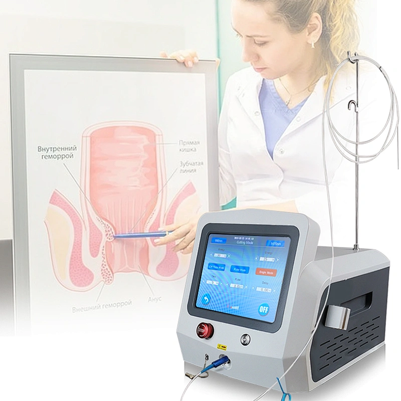 German Latest Tech Proctology Surgical Painless Hemorrhoidectomy Diode Laser 980nm 1470nm Piles Hemorrhoids Laser