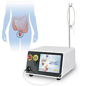980nm 1470nm Hemorrhoid Laser Surgery Diode Laser Treatment Proctology Hemorrhoid