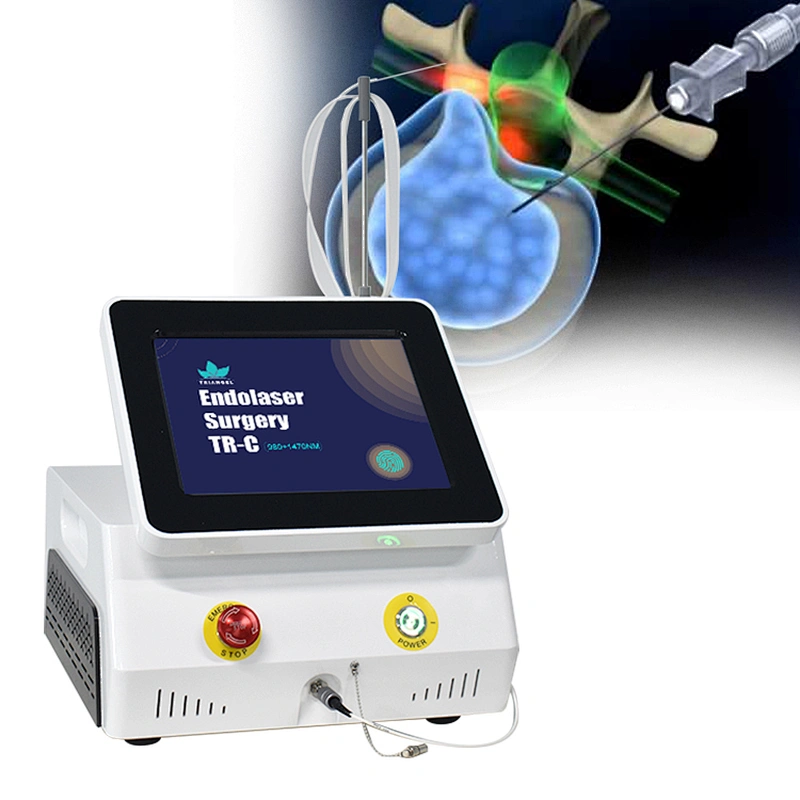 Portable 980nm 1470nm Diode Laser for Surgical PLDD-Percutaneous Laser Disc Decompression Kyphoplasty Treatment