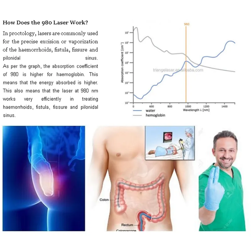 Anal Fistula Internal External Hemorrhoids Remover Piles Laser Radial Fiber 980nm 1470nm Piles Surgical Laser Instrument