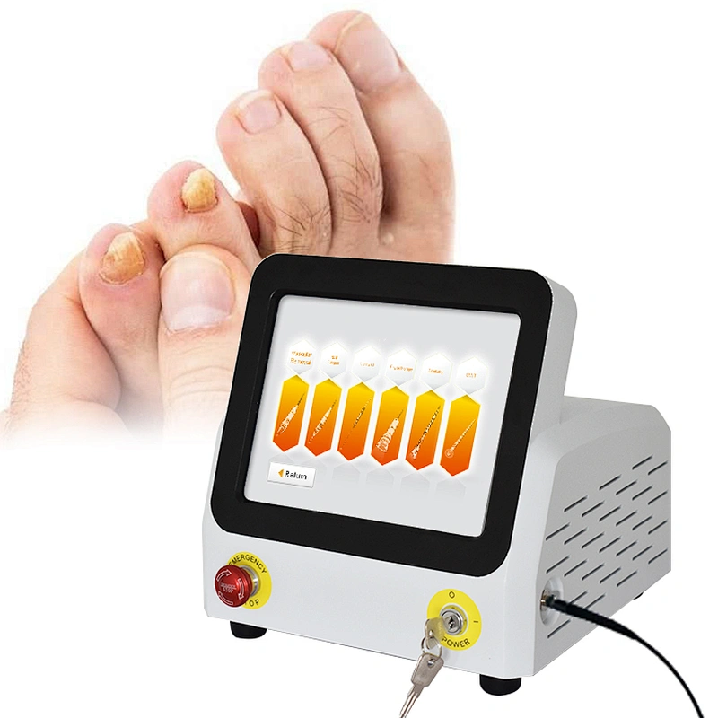 Hot Sale Class IV Laser for Nail Fungus Treatment Medical Equipment Podiatry Nail Fungus Onychomycosis Laser Podiatry Laser