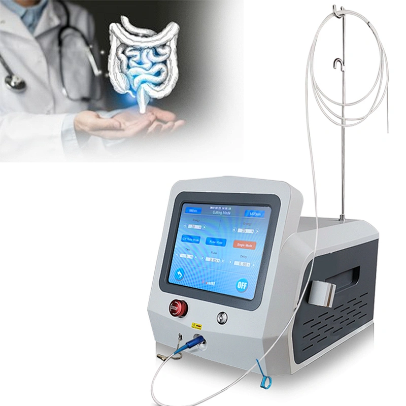 Factory Price Hot Sale Proctology Laser Surgery Machine Diode Laser 980nm1470nm Treatment Hemorrhoids(piles)