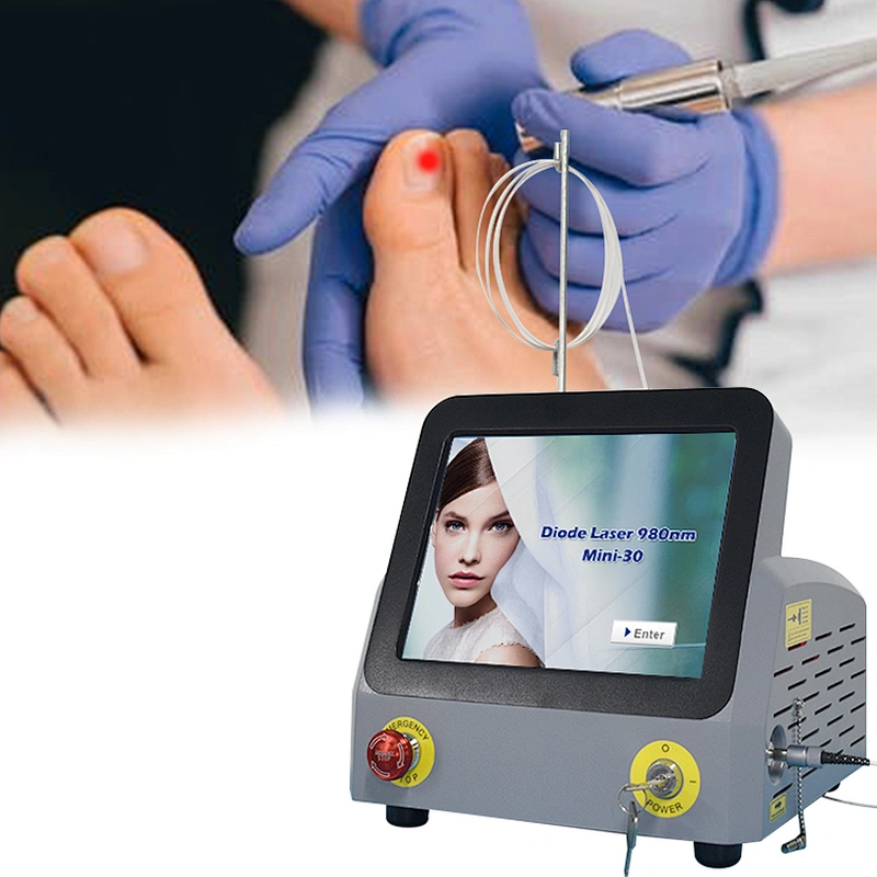 Portable High Power 980nm 30W Diode Laser Remove Nail Fungus Podiatry Onychomycosis Treatment Machine