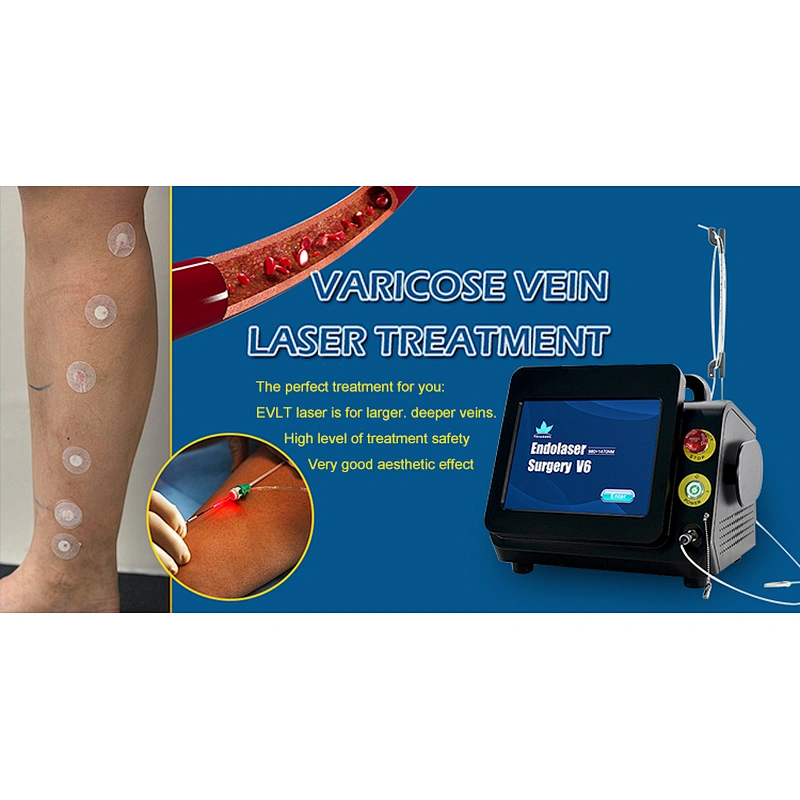 Laser  Varicose Veins 980nm 1470nm  EVLT Endovenous Machine