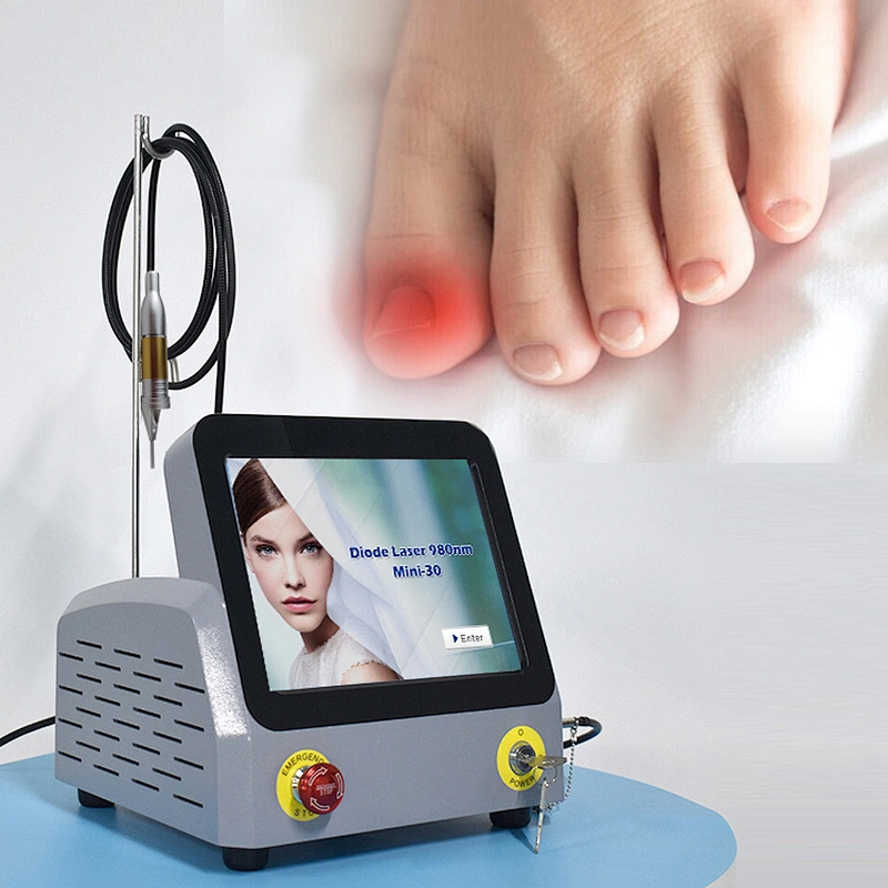 2025 Triangel Hot Sale 30w Podiatry Laser Treatment Machine 980nm Diode Laser Nail Fungus Treatment Device
