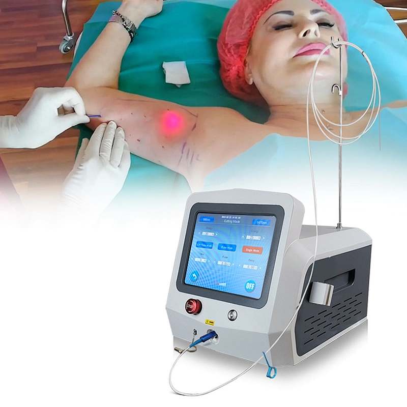 1470nm Laser Lipolysis Plastic Surgery / 1470nm Endolaser Liposculpture Laser