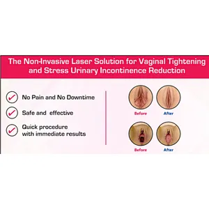 Dermatology Gynecology Laser Machine for Skin Rejuvenation Scar Removal Vagina Tightening