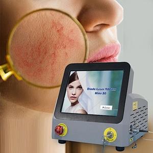 Portable Non-invasive Spider Vein Vascular Diode Laser Vascular Removal 980nm Laser Vascular Removal Machine