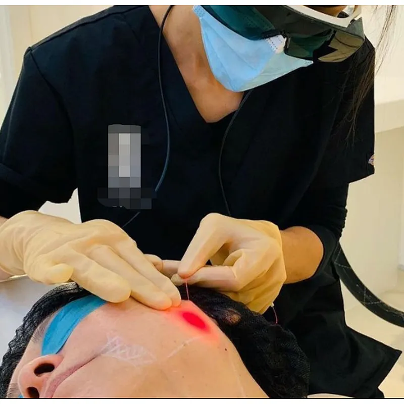 980nm Laser Liposuction Fat Reduction Tighten Skin Lipolysis  Machine