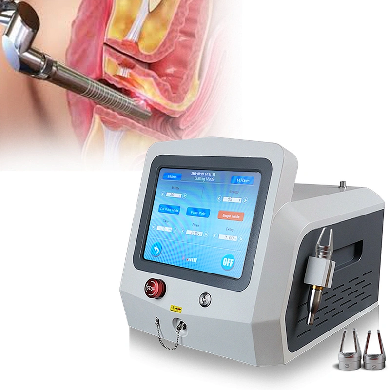 New Arrival 980nm1470nm 30W Diode Laser Intimate Tightening Vaginal Tightening Laser Machine