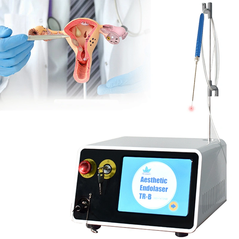 Minimally Medical 980nm 1470nm Diode Laser Gynecology Therapy Instruments for Vaginal Rejuvenation