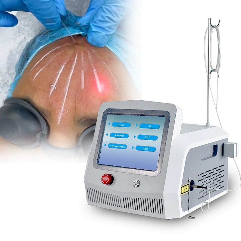 Best Minimally Invasive Facial Sculpting Neck Lifting Treatment Diode Laser 980nm 1470nm Laser