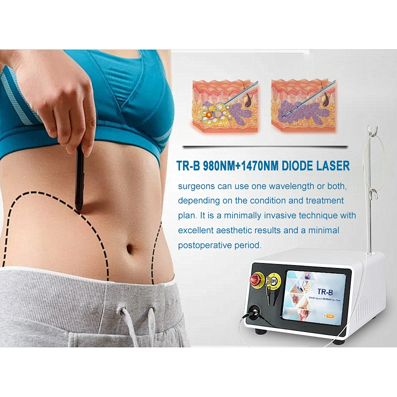 2024 Newest Class IV Facelifting 980nm 1470nm Lipolysis Dual Wavelength Minimally Invasive Laser Device