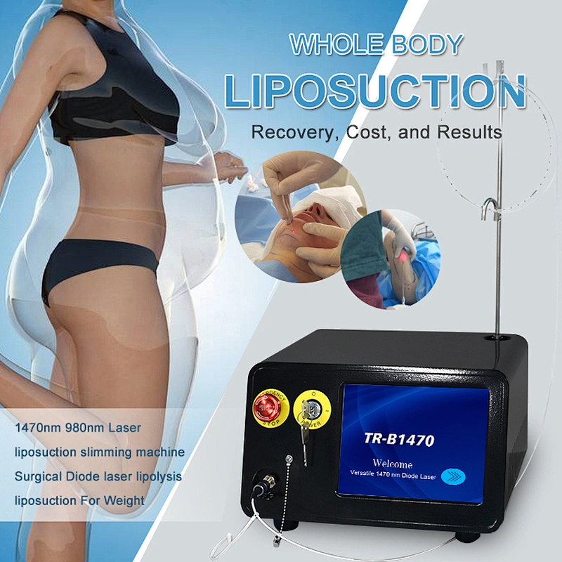 Fat Removal Body Slimming Machine  1470nm  Lipolysis Vaser Liposuction  Laser Lipoma Removal