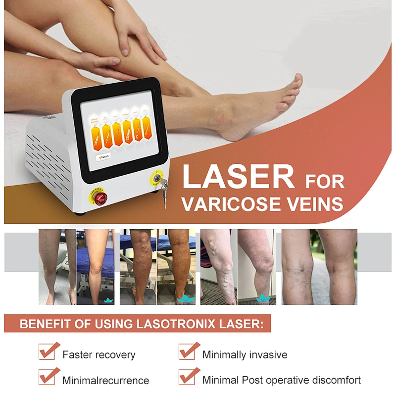 The Newest 980nm Laser  Varicose Veins EVLT EVLA Machine