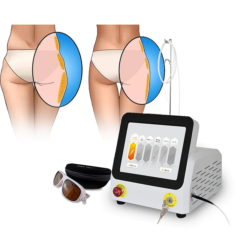2024 Hot 980nm Vaser Laser Medical Plastic Surgery Laser Machine Liposuction Endolaser Facelift Machine