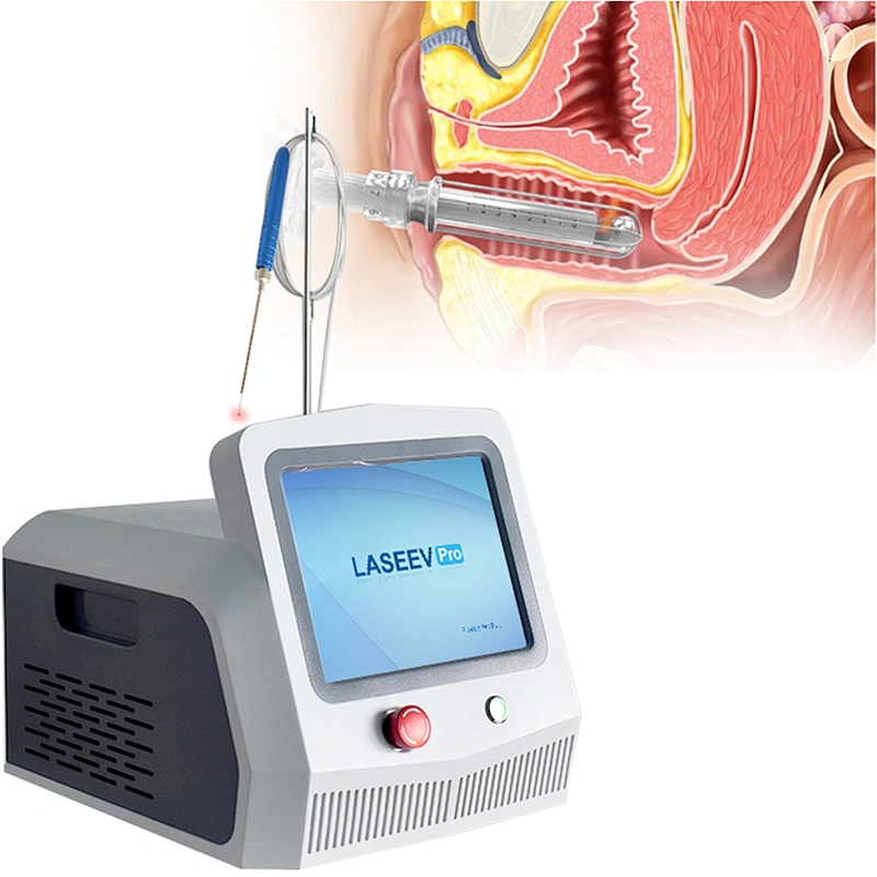 2025 Portable Medical 980nm1470nm 47W Diode Laser Gynecology Vaginal Tightening Laser Machine
