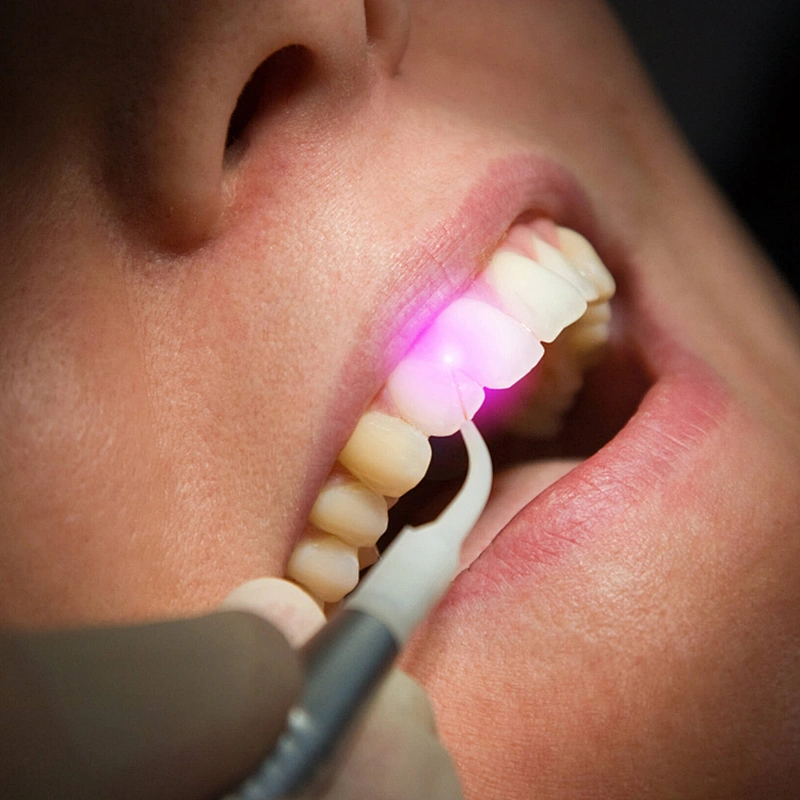 Hot Sale Diode Laser 1470nm 980nm Teeth Whitening Laser Medical Equipment Cutting Soft Tissue Dental Laser Machine
