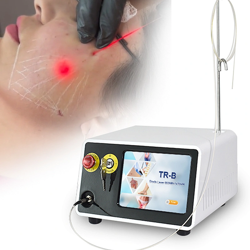 Non-Surgical Liposuction 1470 nm Laser Face Lift Jowl Lift Laser Machine