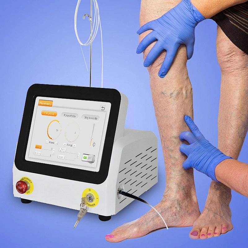 60W High Power Varicose Veins Treatment Machine Removal Legs Varicose Veins 980nm Fiber Diode Laser Medical Equipment