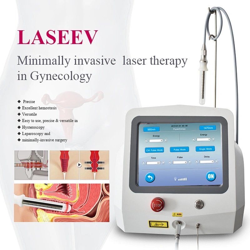 980 1470nm Diode Laser Gynecology Vaginal Minimally Non Invasive Laser Therapy Vaginal Tightening Machine Gynecology Laser