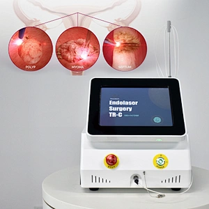 980nm 1470nm Cosmetic Gynecology Laser Diode Device Non Surgical Portable Vaginal Rejuvenation