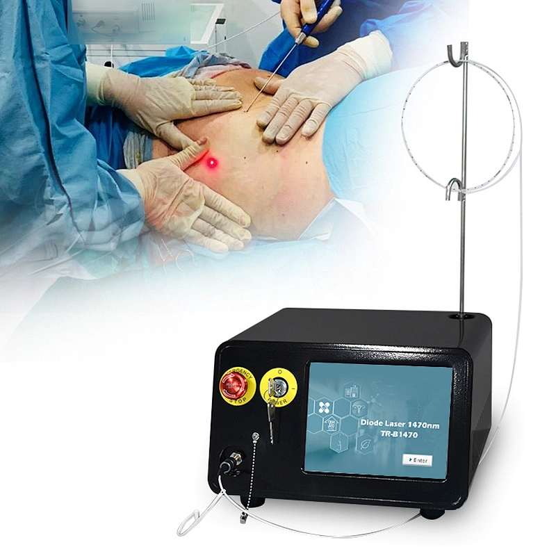 1470nm Machine Liposuction  Laser Plastic Surgery Endolaser Machine