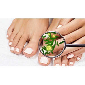 Nail Fungus Treat High Power 30w Podiatry Laser 980nm Diode Laser Machine
