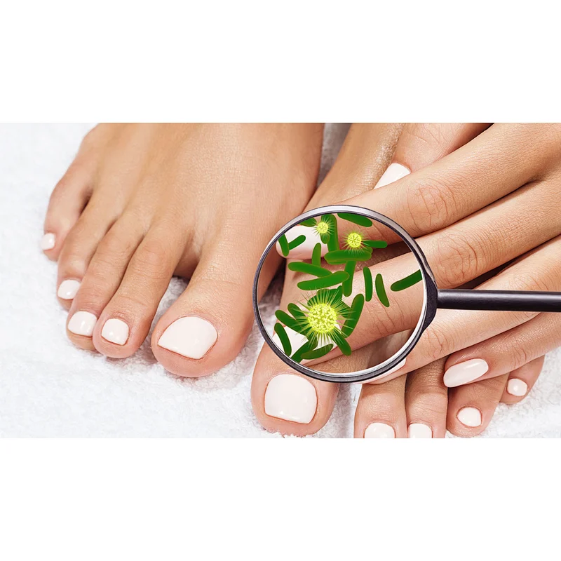 Nail Fungus Treat High Power 30w Podiatry Laser 980nm Diode Laser Machine