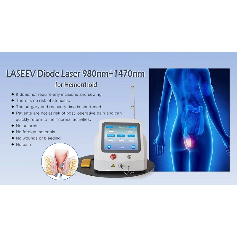 High Quality Hemorrhoids 980nm 1470nm Laser Machine 47w Mini-invasive Treatment for Hemorrhoids Fistula