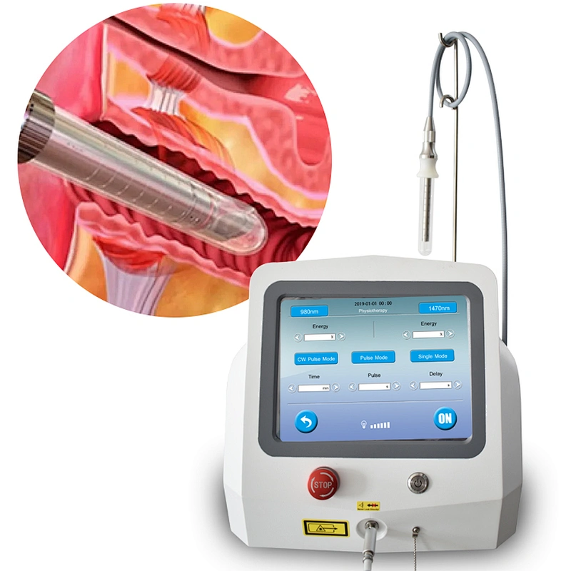 2025 Hot Sale Minimally Invasive 980nm1470nm Diode Laser Vaginal Tightening Laser  Therapy Instruments