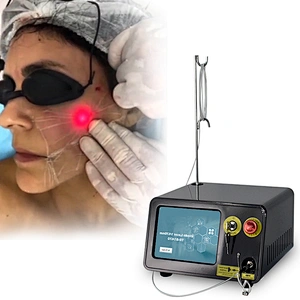 TRIANGELASER Diode Laser Lipolysis Fat Removal 1470nm Lipo Laser Beauty Equipment for Sale