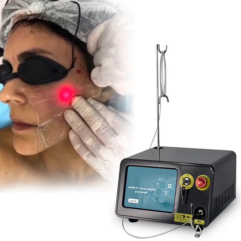 TRIANGELASER Diode Laser Lipolysis Fat Removal 1470nm Lipo Laser Beauty Equipment for Sale