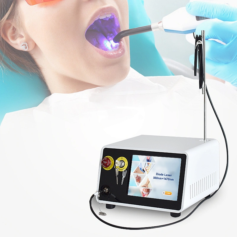 Dental Soft Tissue Laser Machine 980nm 1470nm Diode Dental Laser Treatment Teeth Whitening Instrument
