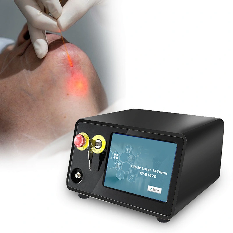 Factory Supply Best Quality Liposuction Lipolysis Endolaser Fat Reduction Skin Rejuvenation Face Lifting Laser 1470nm