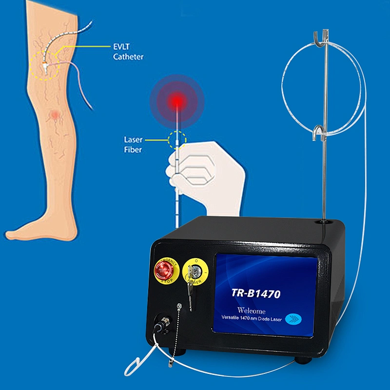 17W New Products Diode Laser 1470nm Varices EVLT Varicose Veins Treatment Machine for Clinic
