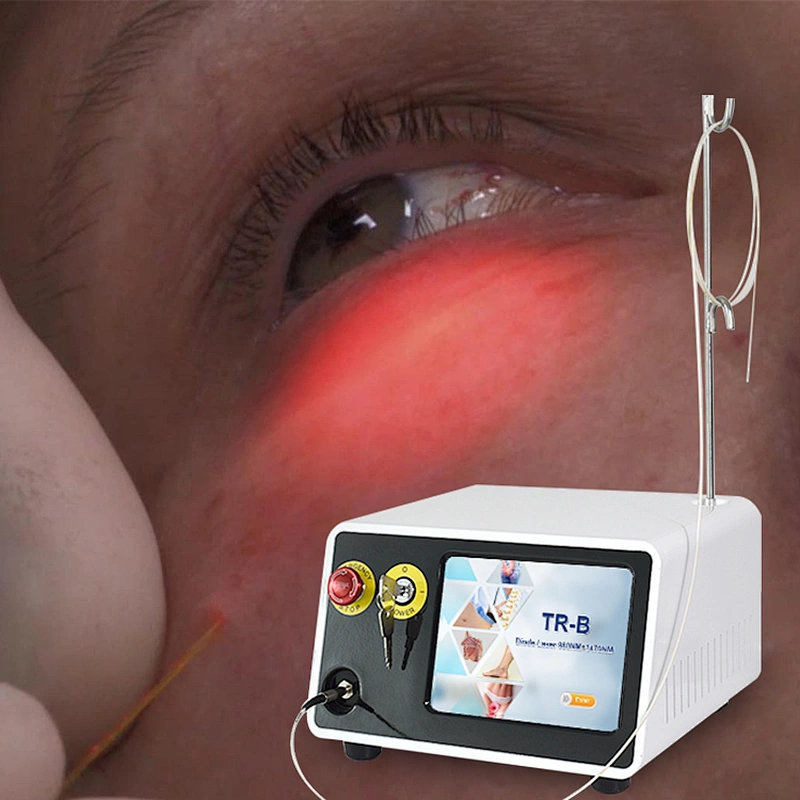 Newest Endolaser 1470nm 980nm Diode Laser Face Lifting Liposuction Machine Liposuct Endo Laser Lift