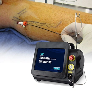 Dual Wave 980nm Class Iv Surgical Laser Equipment for Varices Des Membres Inferieurs Varicose Veins Evlt  Evla Varice