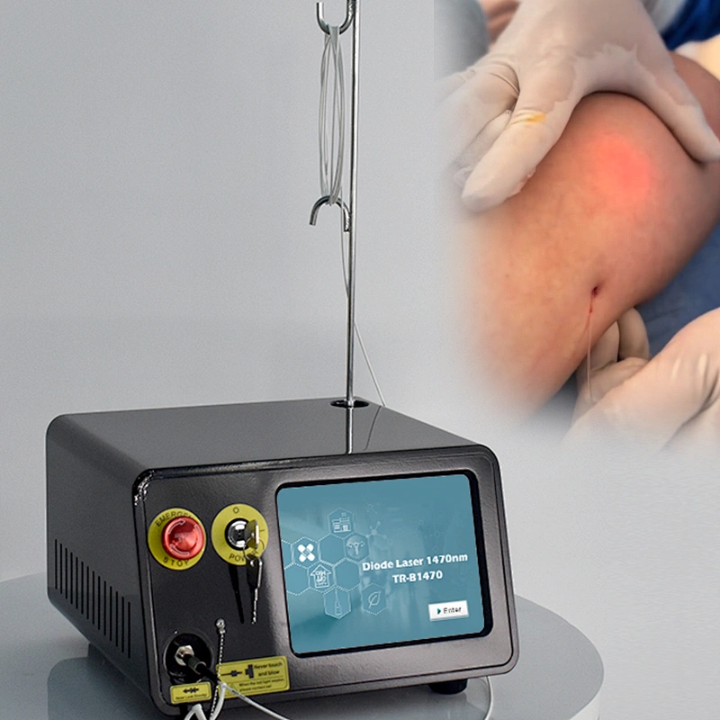 Most Effective 1470nm Laser Liposuction Machine Endolaser Lifting Diode Laser