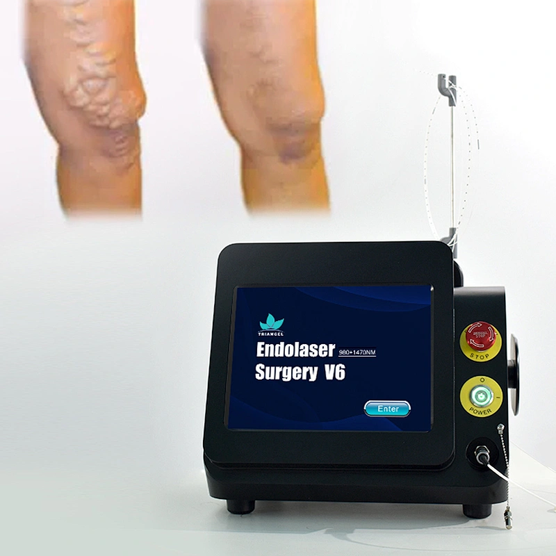 Dual Wave 980nm Class Iv Surgical Laser Equipment for Varices Des Membres Inferieurs Varicose Veins Evlt  Evla Varice