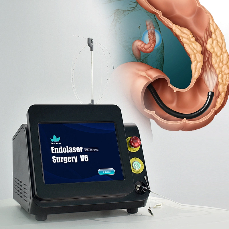 980nm 1470nm Diode Laser for Hemorrhoids Removal Surgery Proctology Haemorrhoids Cutting